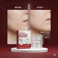 Gentle Cleansing Skin Nursing Adhesive Bandage